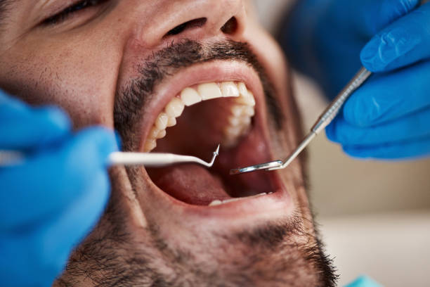 Best Urgent Dental Care for Toothaches in East Camden, AR